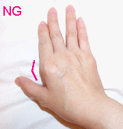 NG